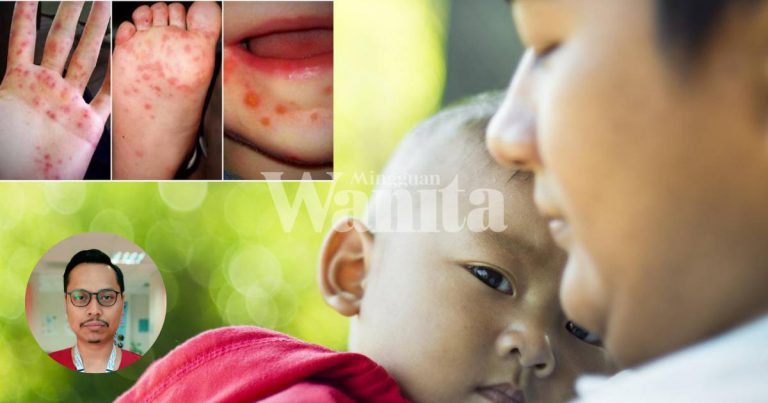 Lepas Raya, Periksa Kesihatan Anak Bawah 5 Tahun, Bimbang Risiko Penyakit Berjangkit HFMD