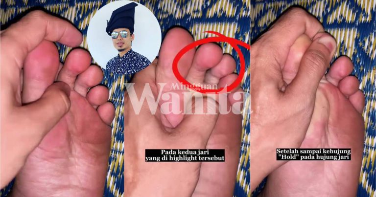 Pemuda Ini Ajar Teknik Urutan Untuk Terangkan Penglihatan Mata Kabur, Kena Cuba!