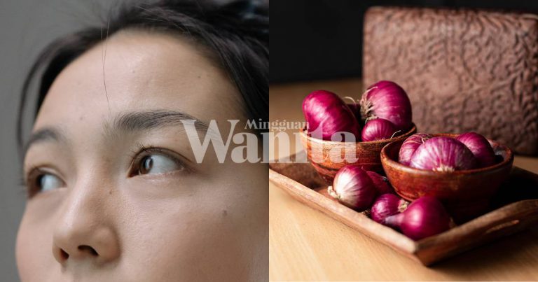 Cara Mudah Hilangkan Jeragat, Guna Getah Bawang Merah & Nampak Awet Muda Lagi!