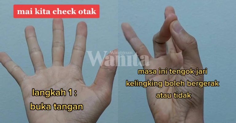 Buat Gerakan Ini Dengan ‘Check’ Otak  Anda & Tiada Risiko Strok, Kena Cuba!