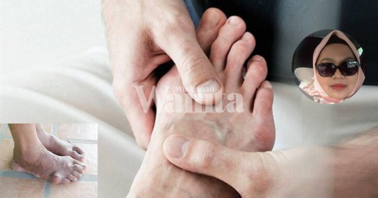 16 Bahan Semulajadi Paling Berkesan WAJIB CUBA Untuk Rawat GOUT
