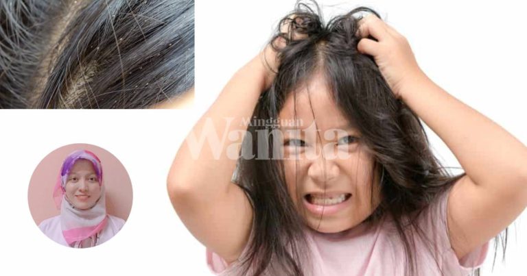 Anak-Anak Mudah Terkena Jangkitan Kutu Kepala, Tak Jaga Kebersihan, Suka Kongsi Mainan Puncanya