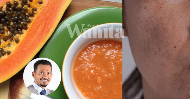 Petua Kulit Muka Kusam Jadi CERAH & Licin, Gunakan Pes BETIK