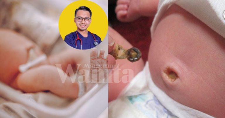 Jangan Sapu Ubat Gamat Pada Tali Pusat Bayi, Wajib Dibersihkan Guna Antiseptik Dibekalkan Hospital
