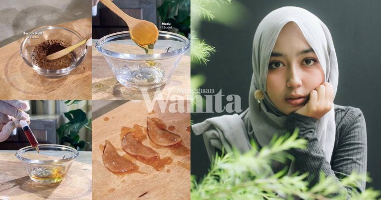 Petua Cepat Hilangkan Parut Jerawat SEBELUM RAYA, Guna Adunan Air Kopi, Kulit Cerah, Berseri