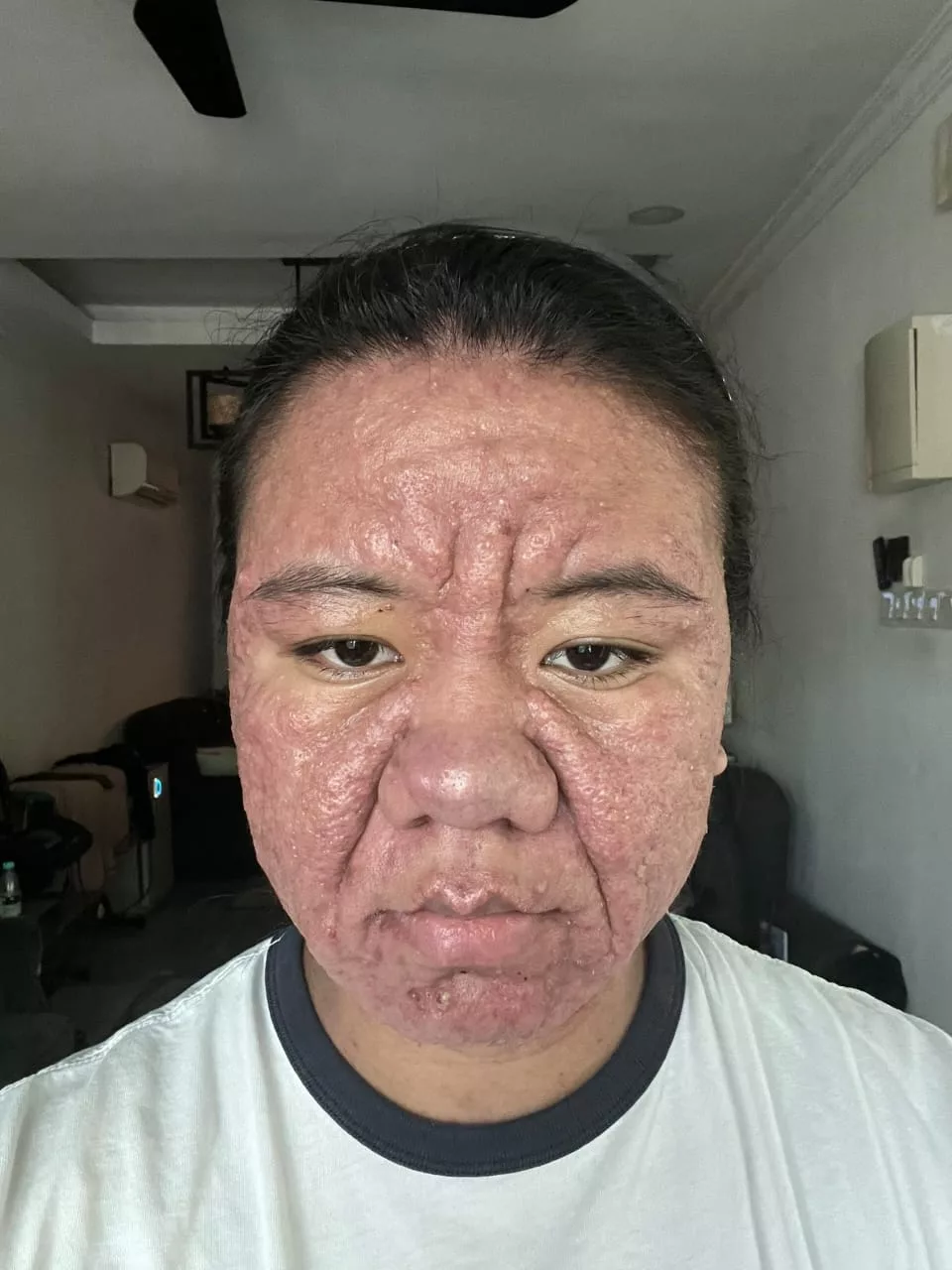 Bukan Penyakit Ain, Wajah Wanita Berkedut Ketika Hamil Kembali Pulih Selepas Bersalin
