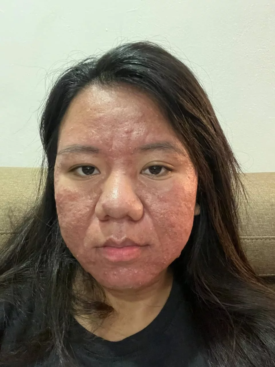Bukan Penyakit Ain, Wajah Wanita Berkedut Ketika Hamil Kembali Pulih Selepas Bersalin