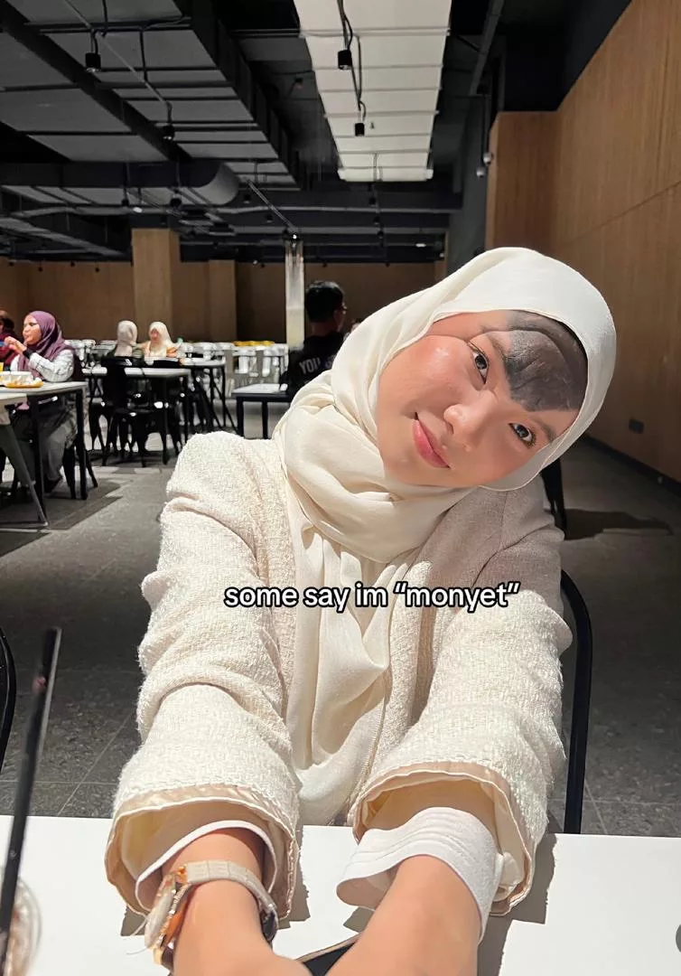 Tanda Lahir Di Dahi, Syamimi Afrina ‘Dihina’- Ada Makcik Tanya, “Suami Tak Nak Cerai Ke…”
