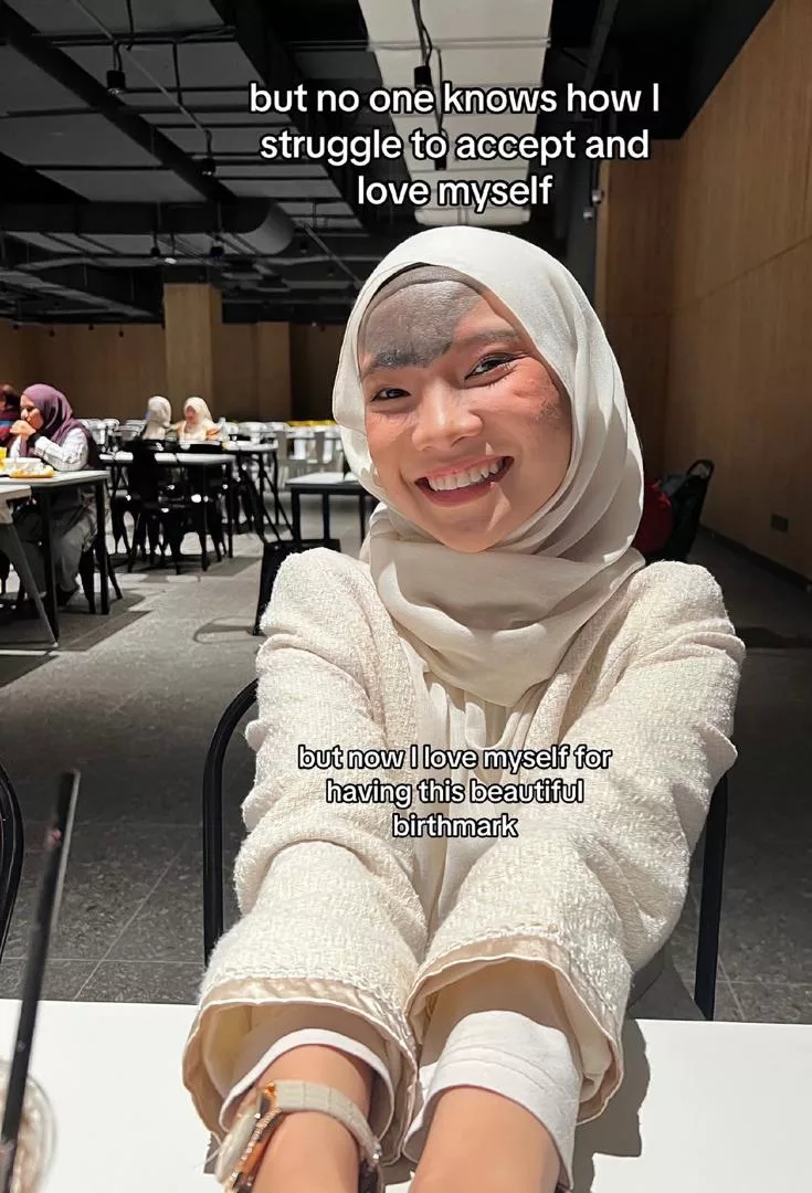 Tanda Lahir Di Dahi, Syamimi Afrina ‘Dihina’- Ada Makcik Tanya, “Suami Tak Nak Cerai Ke…”