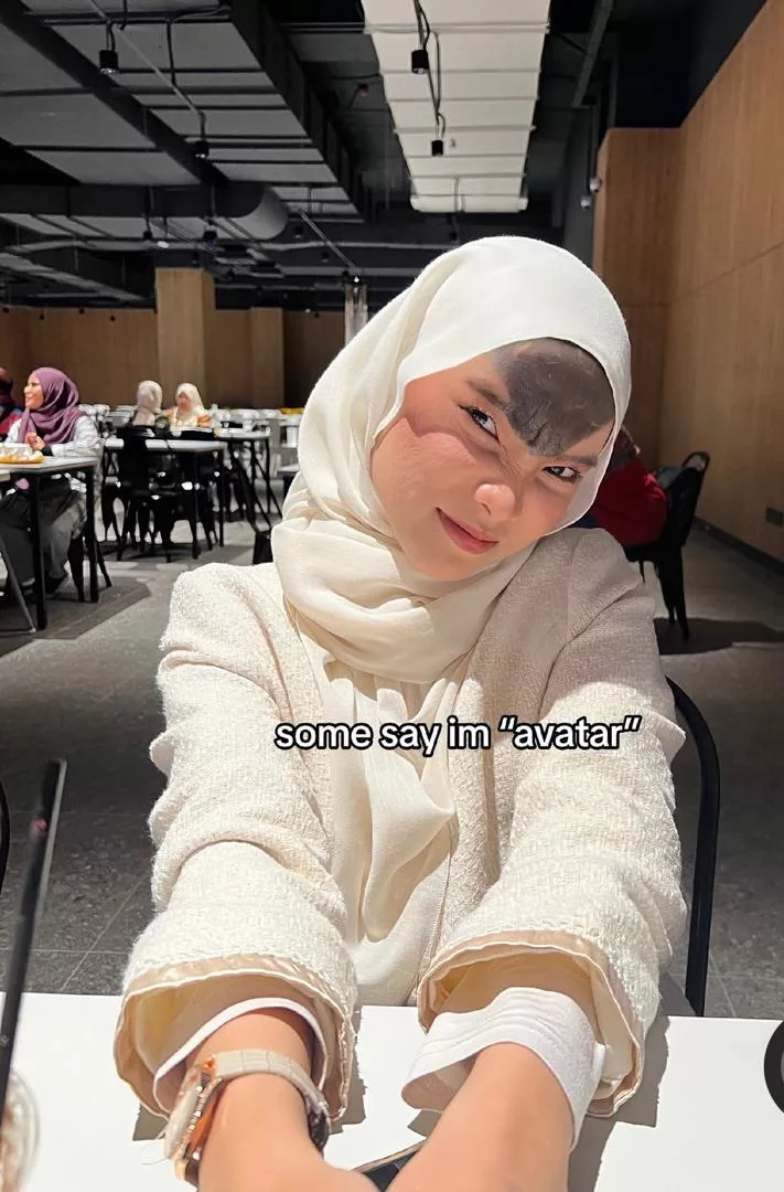 Tanda Lahir Di Dahi, Syamimi Afrina ‘Dihina’- Ada Makcik Tanya, “Suami Tak Nak Cerai Ke…”