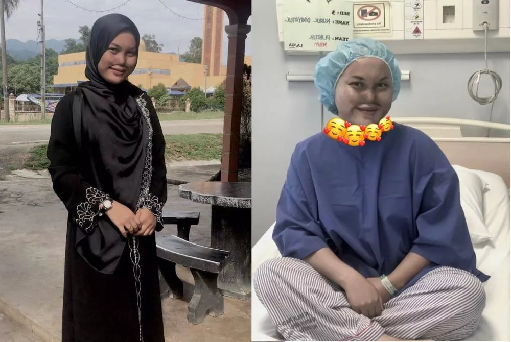 Gadis Mangsa Disimbah Cuka Getah Jalani Pembedahan Hidung, Tak Pernah Berdendam Perbuatan Bapa 9 Gadis Mangsa Disimbah Cuka Getah Jalani Pembedahan Hidung, Tak Pernah Berdendam Perbuatan Bapa