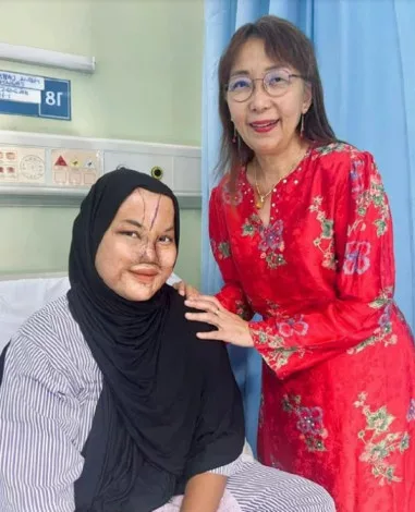 Gadis Mangsa Disimbah Cuka Getah Jalani Pembedahan Hidung, Tak Pernah Berdendam Perbuatan Bapa 10 Gadis Mangsa Disimbah Cuka Getah Jalani Pembedahan Hidung, Tak Pernah Berdendam Perbuatan Bapa