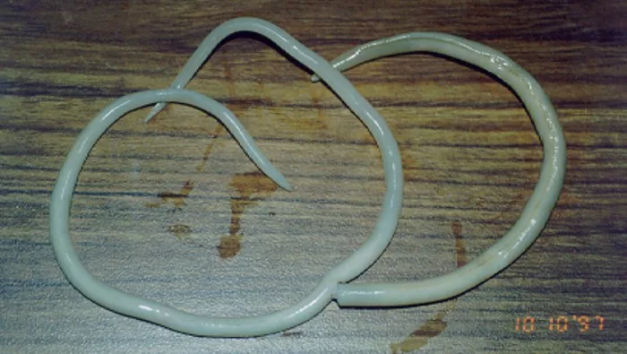 Anak Kecil 4 Tahun Meninggal Akibat Perut Penuh Cacing Gelang, Tragedi Timpa Adik Raya Menyayat Hati