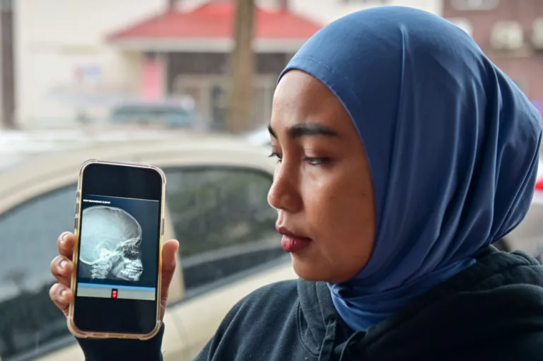 Anak Tahun Dua Patah Hidung & Retak Tulang Mata. Ibu Mahu Tindakan Tegas Isu Buli Sekolah