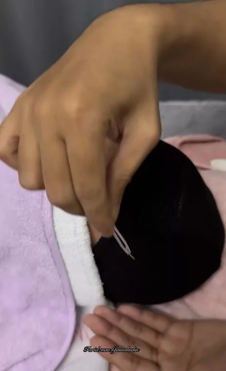 Wanita 50-an Pakai Susuk Di Kening Dan Kemaluan Kerana Takut Suami Cari Lain