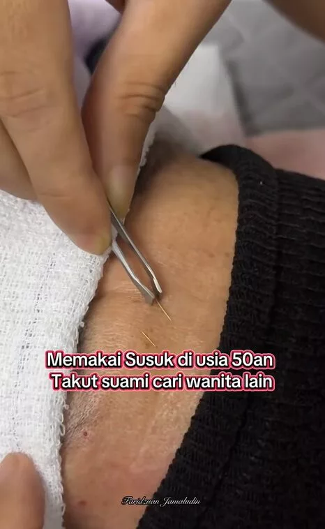Wanita 50-an Pakai Susuk Di Kening Dan Kemaluan Kerana Takut Suami Cari Lain