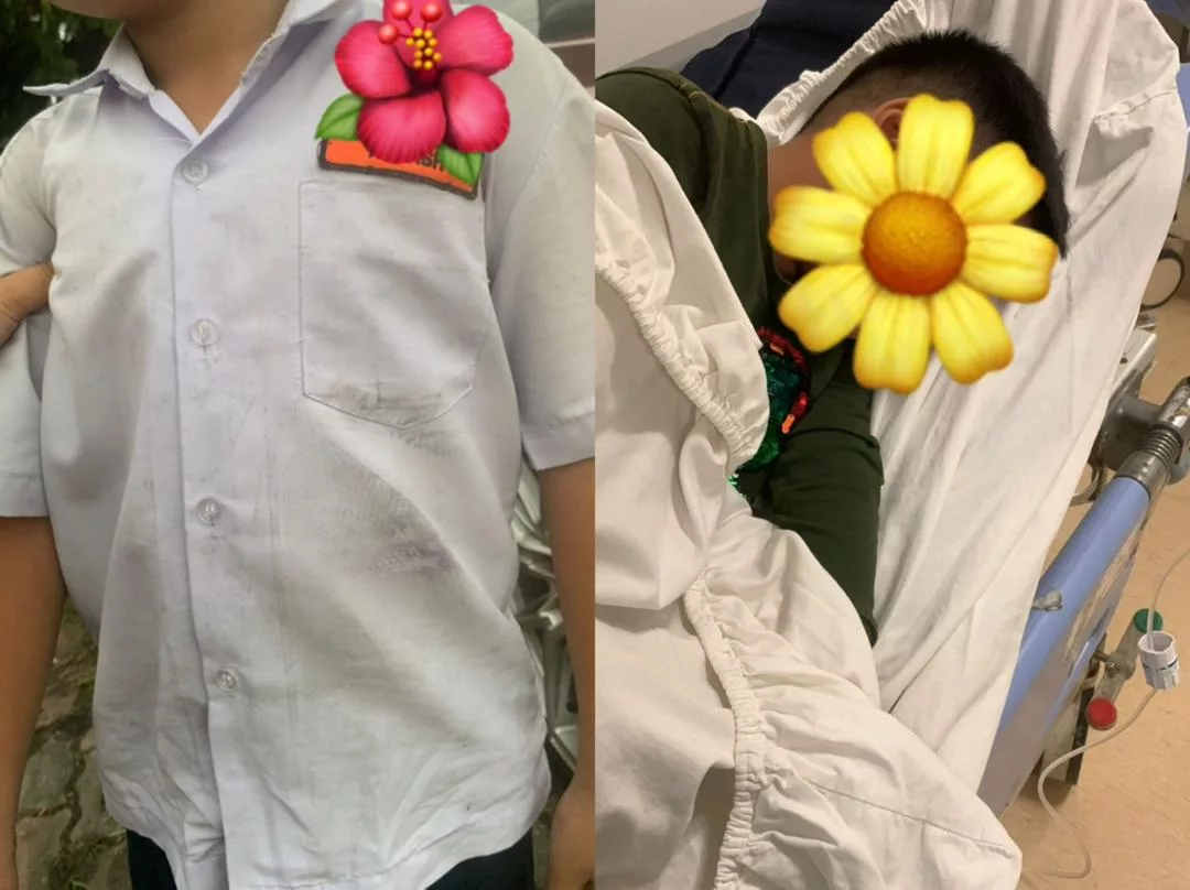 Insiden Murid Tahun Satu Dipukul Di Shah Alam: Polis Siasat Kes Buli Sekolah