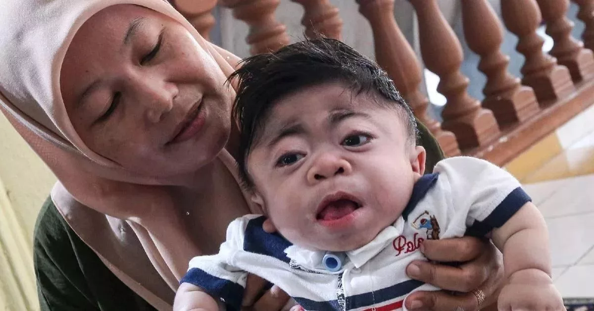 Air Mata Reda Seorang Ibu: Rizki Penghidap Mucolipidosis Tahap Dua Hembus Nafas Terakhir