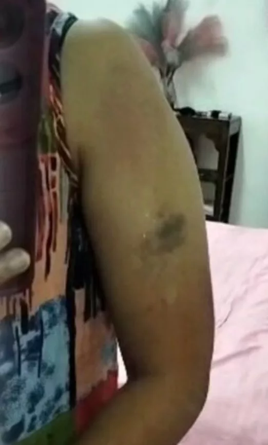 Bekas Isteri Vokalis Dakwa Didera 7 Bulan, Keganasan Rumah Tangga Bukan Isu Peribadi