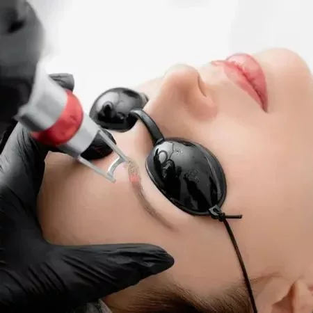 Masalah Milia Seed Sekitar Mata, 3 Cara Ini Boleh Singkirkan Terus Dari Wajah