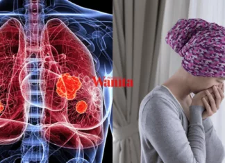 Punca Kanser Paru-Paru: Bukan Perokok Sahaja Berisiko, Ini Faktor Yang Ramai Tak Sedar kanser paru-paru