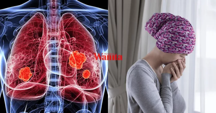 kanser paru-paru kanser paru-paru