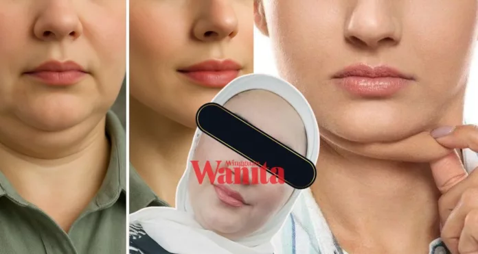 hilangkan dagu berlapis