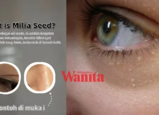 Milia Seed