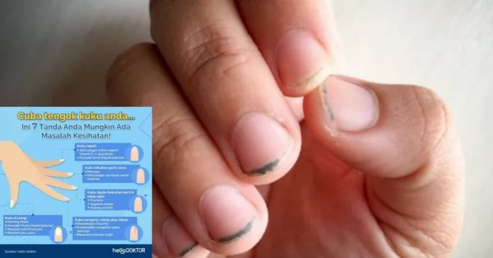 Pesan Dr Malar Sempena Bulan Ramadan, “Peniaga Makanan Sila Bersedia!”