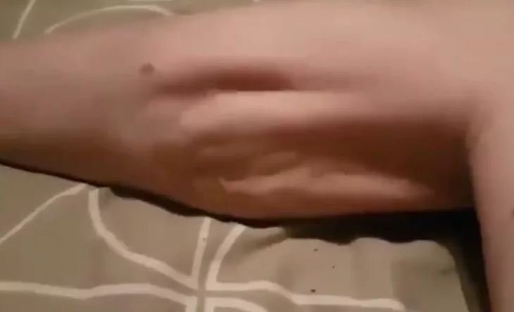 Buat Diet Macam-macam Tapi Berat Badan Tak Turun, Ini Tanda Kortisol Anda Tinggi 6 Buat Diet Macam-macam Tapi Berat Badan Tak Turun, Ini Tanda Kortisol Anda Tinggi