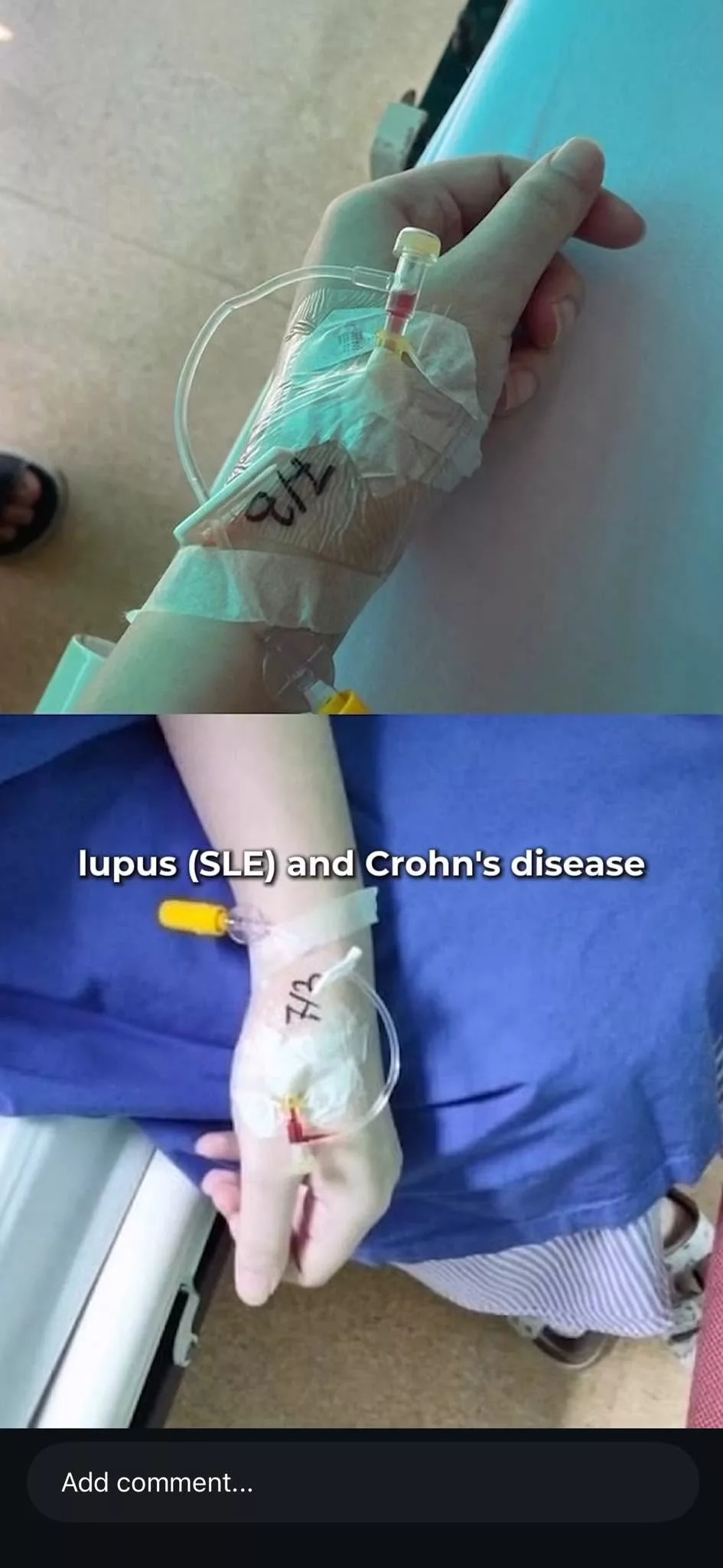 Bertemu Jodoh di Hospital, Pejuang Kanser dan SLE Bersatu Atas Pelamin 6 Bertemu Jodoh di Hospital, Pejuang Kanser dan SLE Bersatu Atas Pelamin