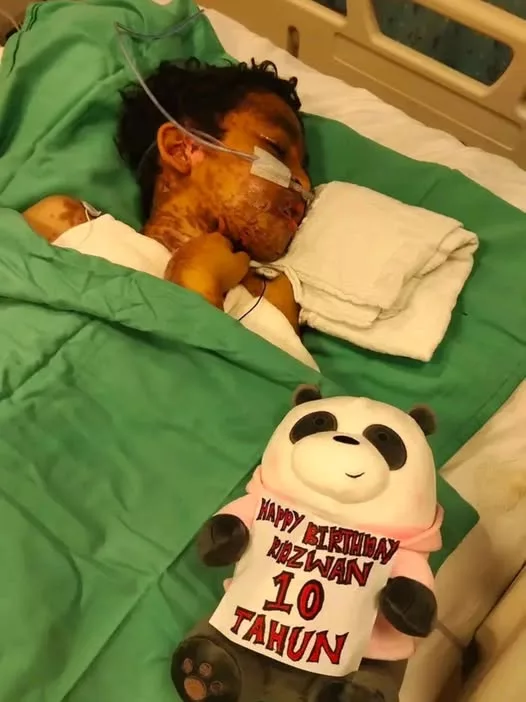 Dipatuk Ular Tedung Cobra Ketika Tidur, Ridzwan 10 Tahun Terlantar Lebih Sebulan Di Hospital & Kini Berjuang Untuk Sembuh 9 Dipatuk Ular Tedung Cobra Ketika Tidur, Ridzwan 10 Tahun Terlantar Lebih Sebulan Di Hospital & Kini Berjuang Untuk Sembuh