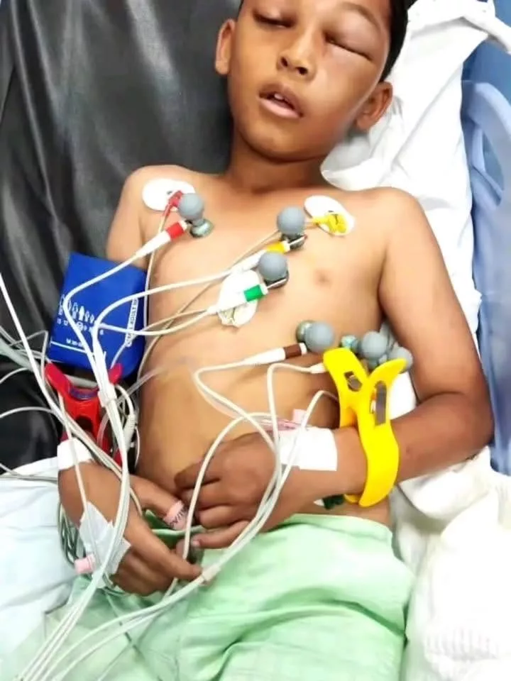 Dipatuk Ular Tedung Cobra Ketika Tidur, Ridzwan 10 Tahun Terlantar Lebih Sebulan Di Hospital & Kini Berjuang Untuk Sembuh 13 Dipatuk Ular Tedung Cobra Ketika Tidur, Ridzwan 10 Tahun Terlantar Lebih Sebulan Di Hospital & Kini Berjuang Untuk Sembuh