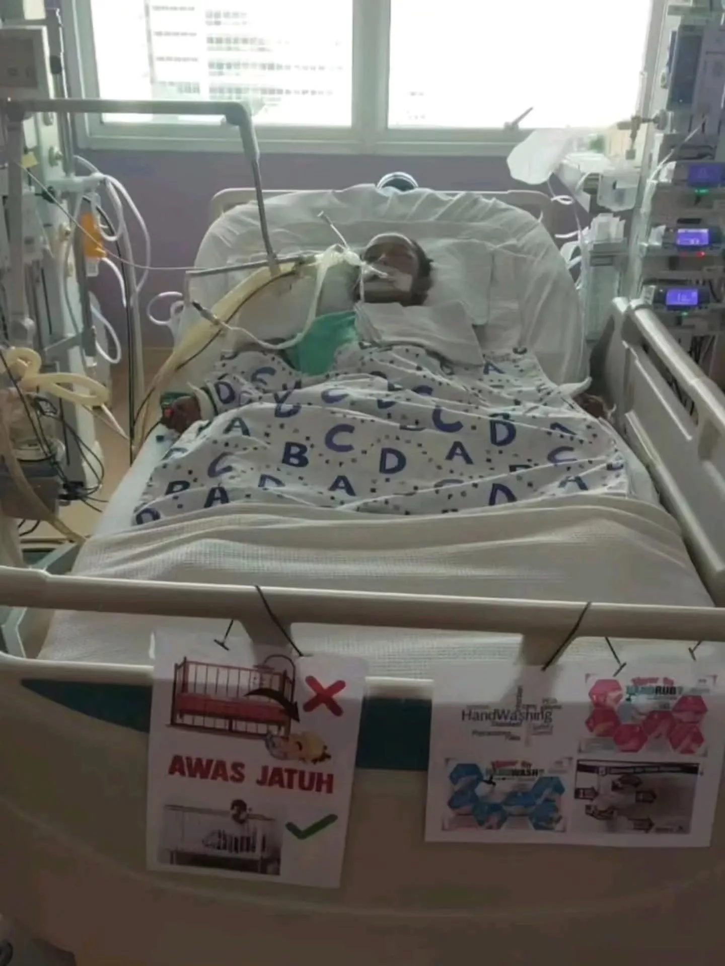 Dipatuk Ular Tedung Cobra Ketika Tidur, Ridzwan 10 Tahun Terlantar Lebih Sebulan Di Hospital & Kini Berjuang Untuk Sembuh 11 Dipatuk Ular Tedung Cobra Ketika Tidur, Ridzwan 10 Tahun Terlantar Lebih Sebulan Di Hospital & Kini Berjuang Untuk Sembuh
