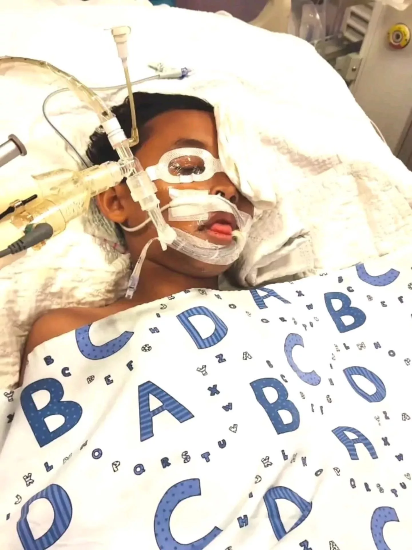 Dipatuk Ular Tedung Cobra Ketika Tidur, Ridzwan 10 Tahun Terlantar Lebih Sebulan Di Hospital & Kini Berjuang Untuk Sembuh 12 Dipatuk Ular Tedung Cobra Ketika Tidur, Ridzwan 10 Tahun Terlantar Lebih Sebulan Di Hospital & Kini Berjuang Untuk Sembuh