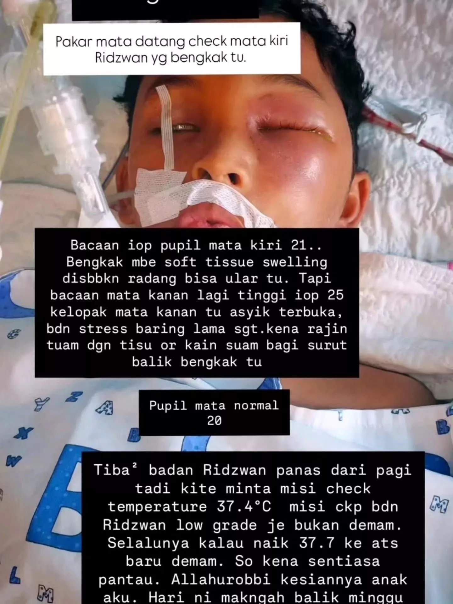 Dipatuk Ular Tedung Cobra Ketika Tidur, Ridzwan 10 Tahun Terlantar Lebih Sebulan Di Hospital & Kini Berjuang Untuk Sembuh 10 Dipatuk Ular Tedung Cobra Ketika Tidur, Ridzwan 10 Tahun Terlantar Lebih Sebulan Di Hospital & Kini Berjuang Untuk Sembuh