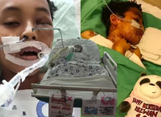 Dipatuk Ular Tedung Cobra Ketika Tidur, Ridzwan 10 Tahun Terlantar Lebih Sebulan Di Hospital & Kini Berjuang Untuk Sembuh Dipatuk Ular Tedung Cobra Ketika Tidur