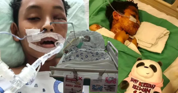 Dipatuk Ular Tedung Cobra Ketika Tidur Dipatuk Ular Tedung Cobra Ketika Tidur