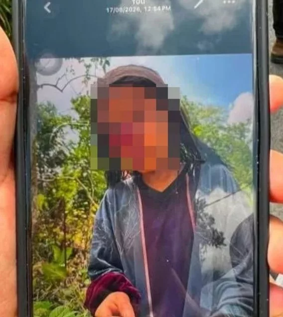 Aktiviti Joging Bertukar Jadi Tragedi, Remaja Perempuan 15 Tahun Dir*gol