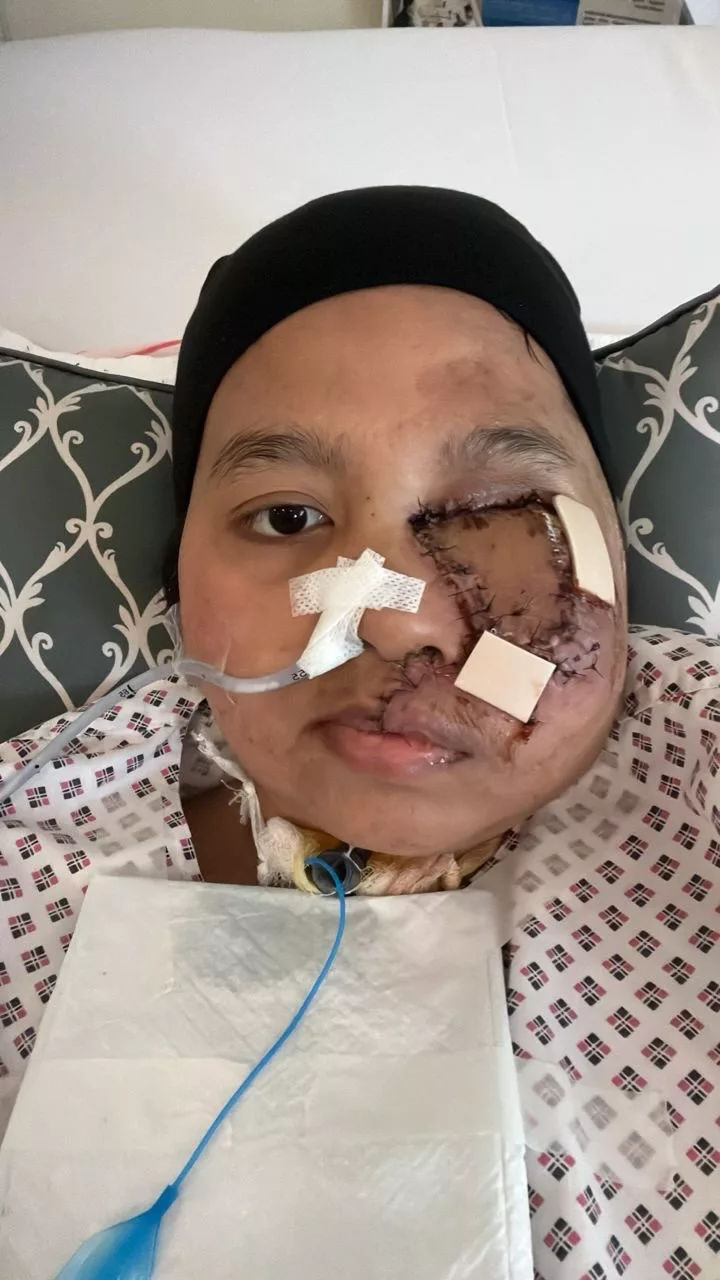 Hidap Kanser Tulang Tahap 4, Suami Setia Jaga Isteri Ketika Sakit & Kini Semakin Sembuh 13 Hidap Kanser Tulang Tahap 4, Suami Setia Jaga Isteri Ketika Sakit & Kini Semakin Sembuh