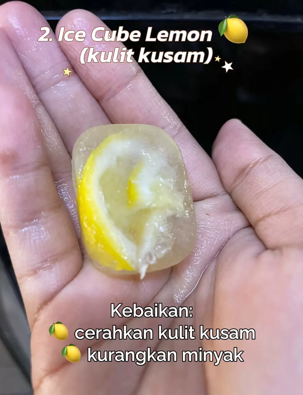 Wanita Ini Kongsi Tip Buat Ice Facial, Bantu Masalah Pori Terbuka & Dark Circle! 11 Wanita Ini Kongsi Tip Buat Ice Facial, Bantu Masalah Pori Terbuka & Dark Circle!