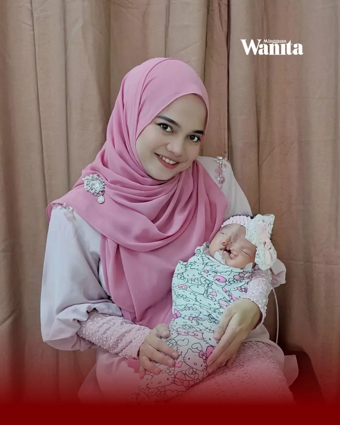 Anak Dilahirkan Klef Pada Wajah, Ibu Reda & Anggap Ujian Ini Satu Ladang Pahala