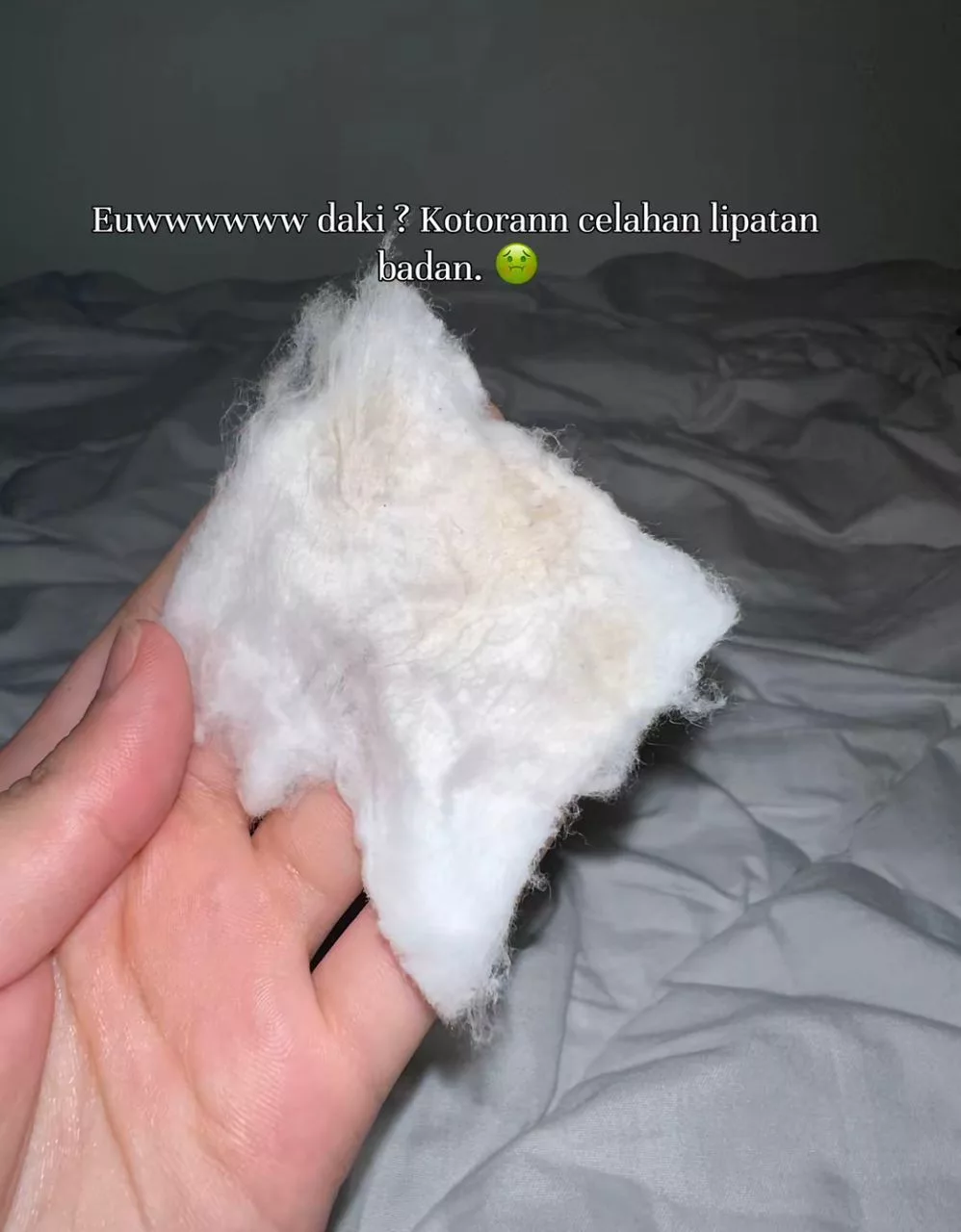 Celah Pelipat Makin Cerah & Bersih, Wanita Ini Kongsi Cara Lebih Berkesan Hilangkan Daki