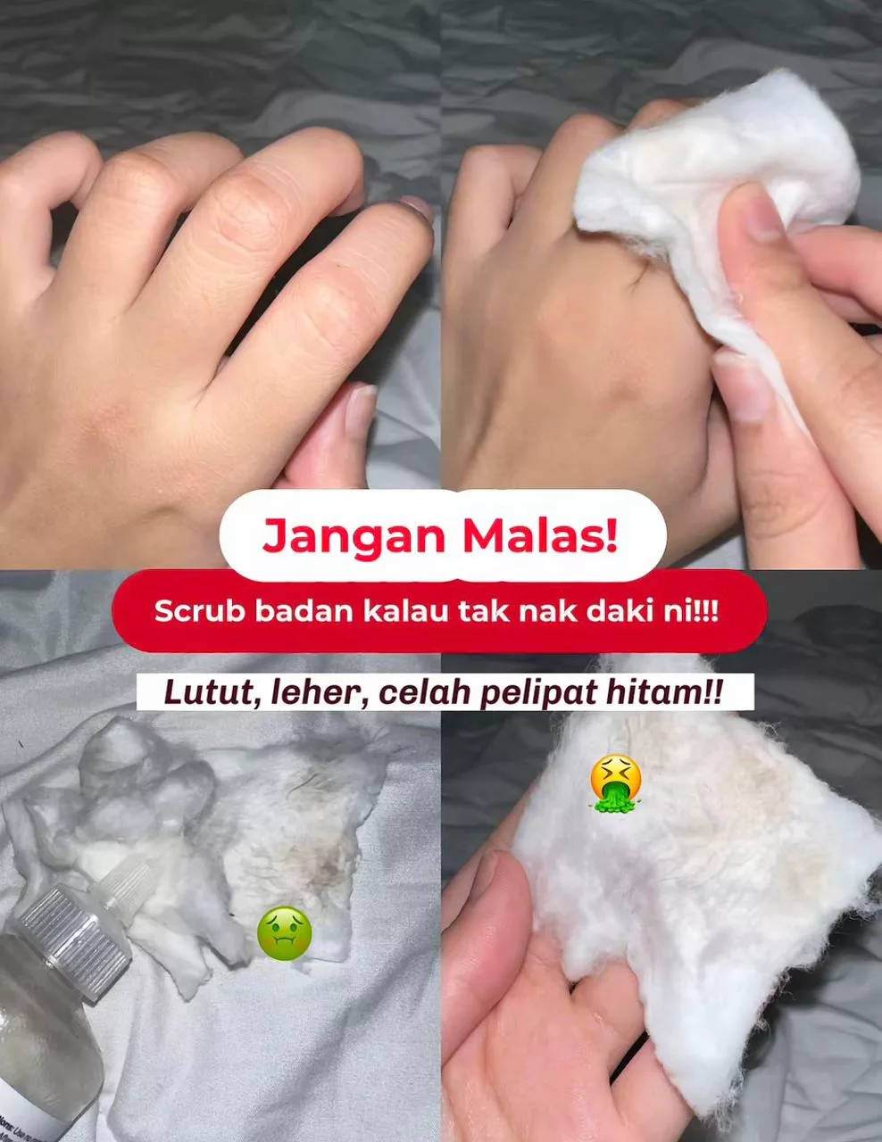 Celah Pelipat Makin Cerah & Bersih, Wanita Ini Kongsi Cara Lebih Berkesan Hilangkan Daki