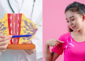 Awas, Kalau Payudara Seperti Kubis Bunga, Itu Petanda Kanser Tahap Akhir! Payudara